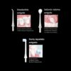 OSOM Oral Care burnos irigatorius (3)-min OSOM Oral Care burnos irigatorius OSOMORAL131WH, baltas